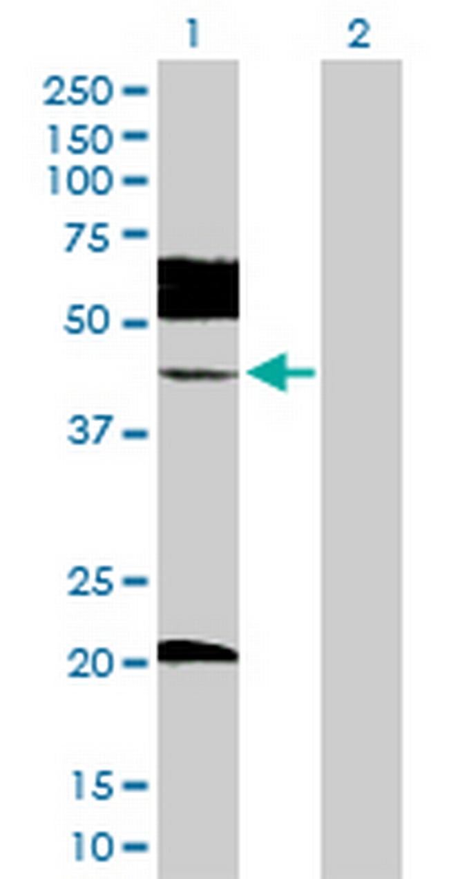 UBE2Q2 Antibody in Western Blot (WB)