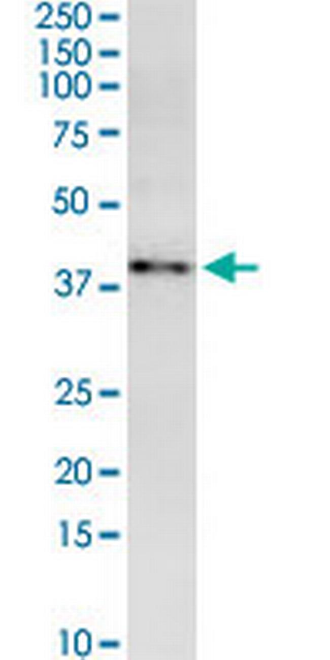 MARCH9 Antibody in Western Blot (WB)
