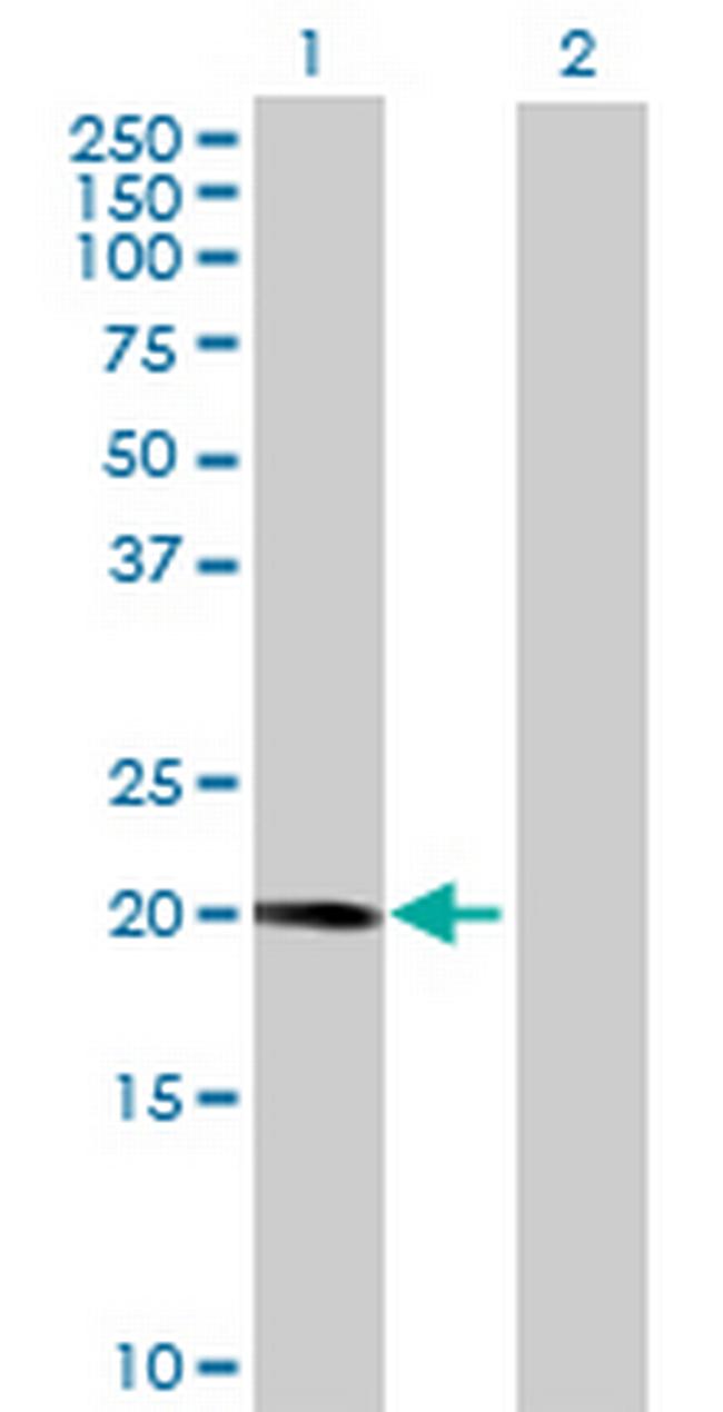 RP11-484I6.3 Antibody in Western Blot (WB)