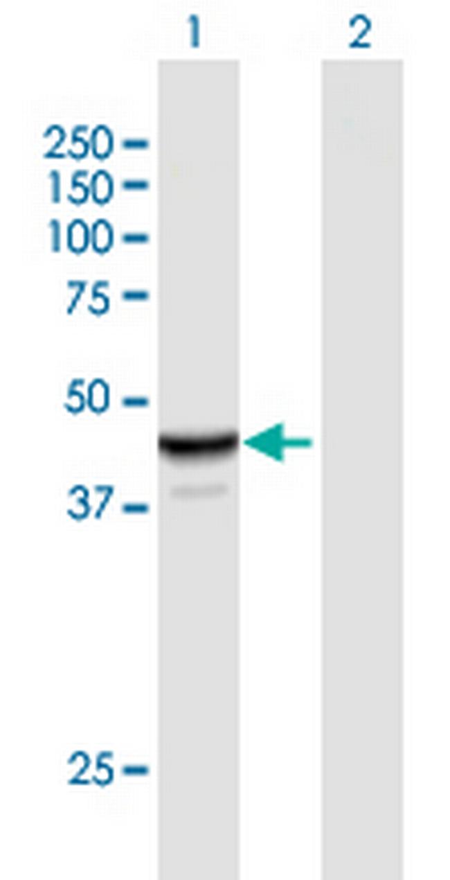 NAPRT1 Antibody in Western Blot (WB)