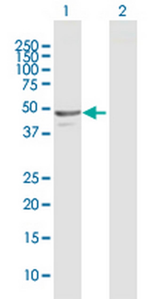 NAPRT1 Antibody in Western Blot (WB)