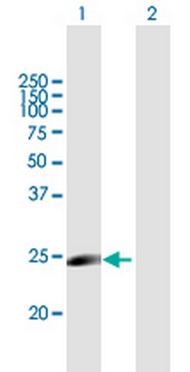 MYLC2PL Antibody in Western Blot (WB)