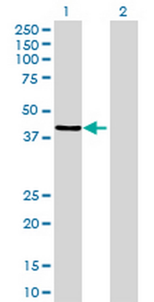 ZNF670 Antibody in Western Blot (WB)