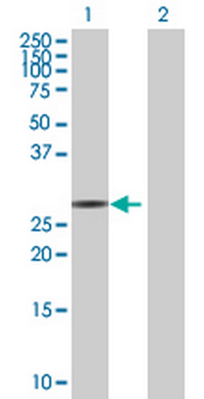FBXO44 Antibody in Western Blot (WB)