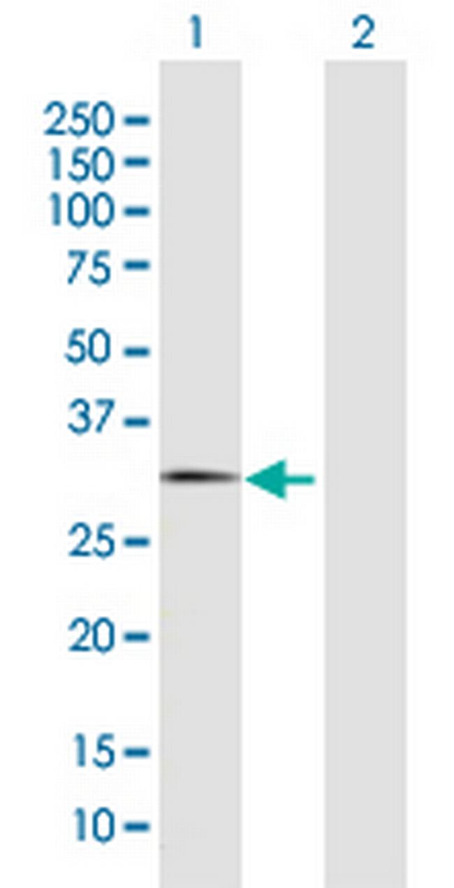 FBXO44 Antibody in Western Blot (WB)
