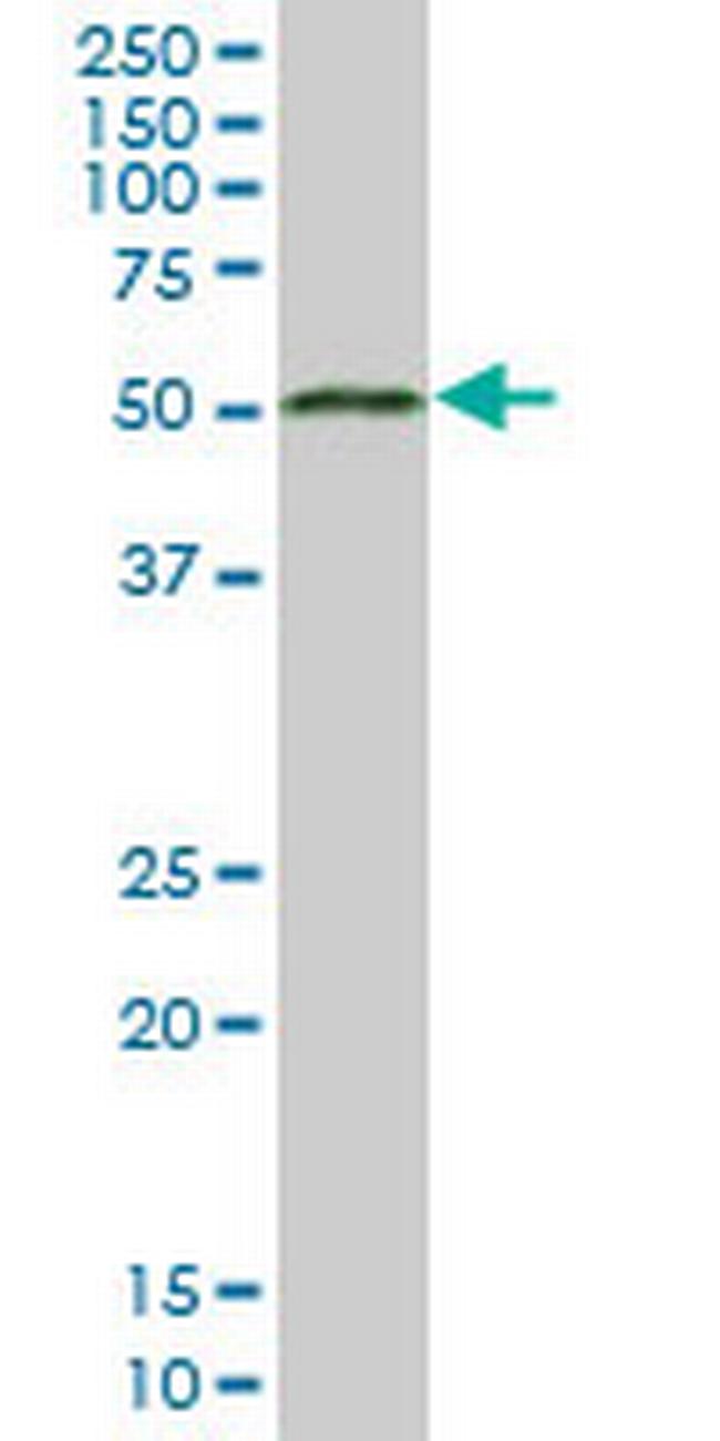 MGC21874 Antibody in Western Blot (WB)