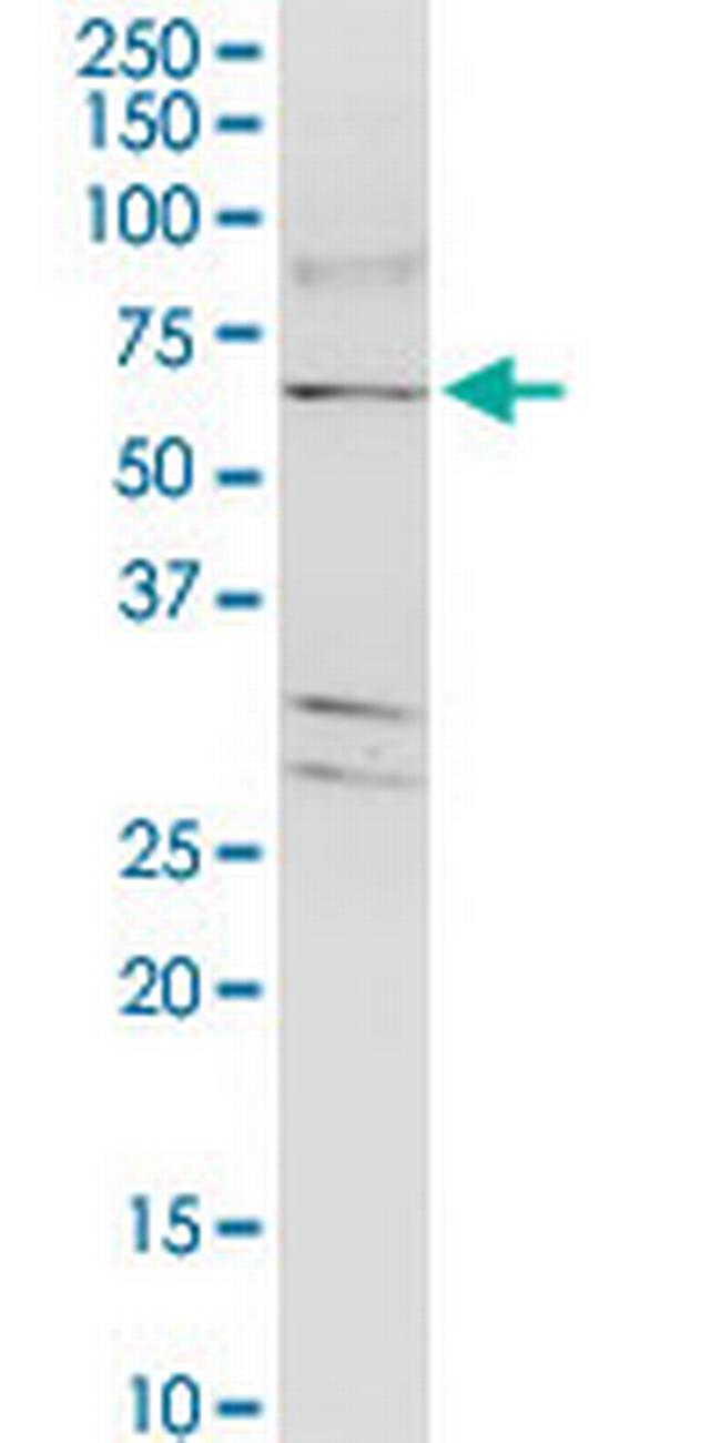 TJAP1 Antibody in Western Blot (WB)