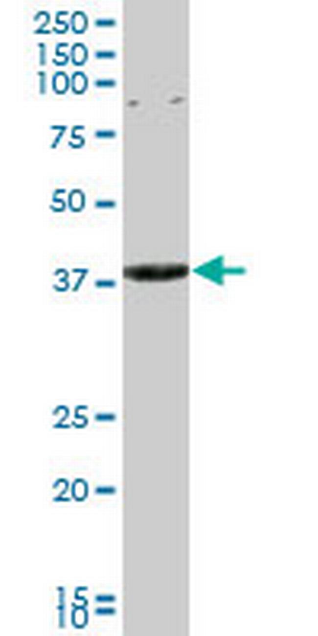 CAPZA3 Antibody in Western Blot (WB)