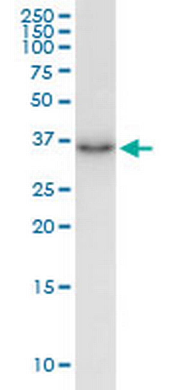 HTRA3 Antibody in Western Blot (WB)