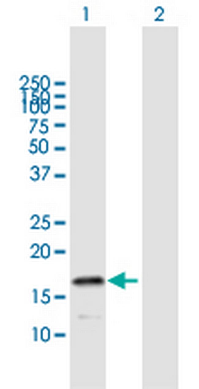 HSPB9 Antibody in Western Blot (WB)
