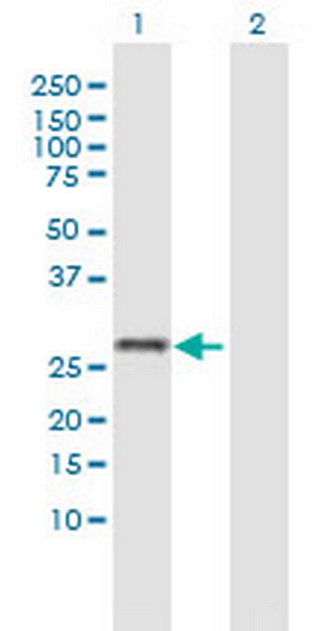 TMEM203 Antibody in Western Blot (WB)