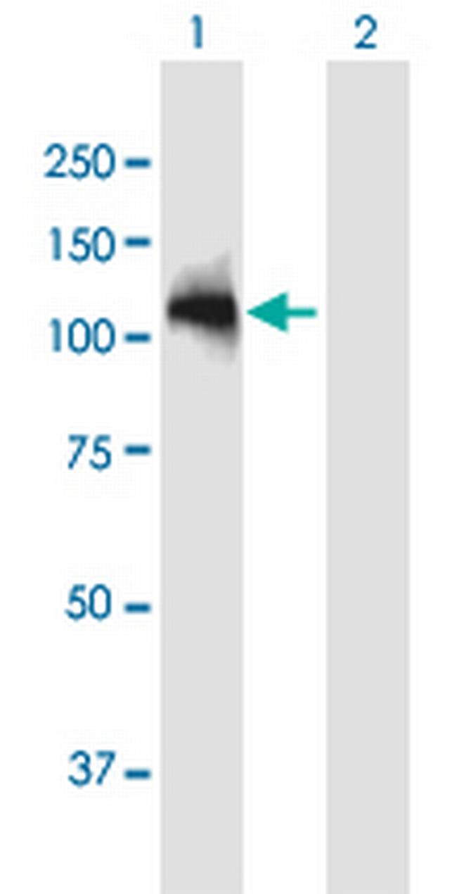 ARHGAP12 Antibody in Western Blot (WB)