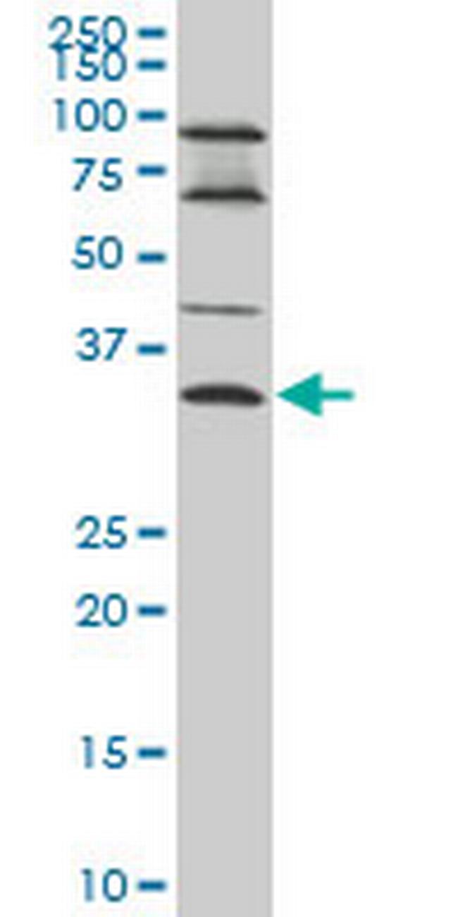 EPSTI1 Antibody in Western Blot (WB)