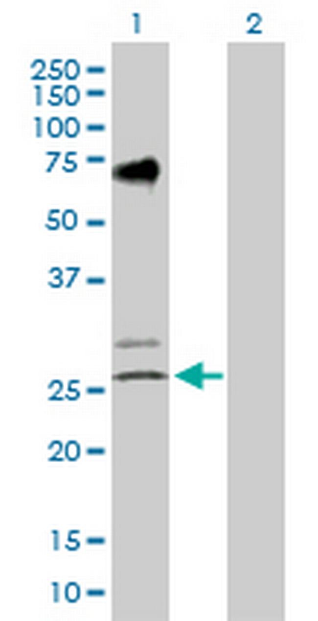 EGLN3 Antibody in Western Blot (WB)
