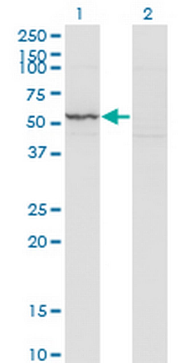 KRT71 Antibody in Western Blot (WB)