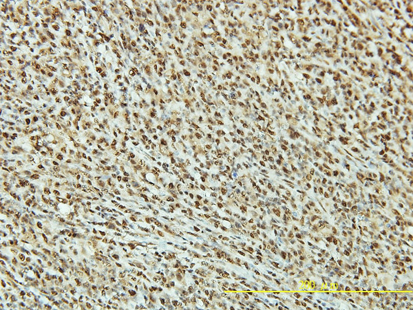 TP53RK Antibody in Immunohistochemistry (Paraffin) (IHC (P))