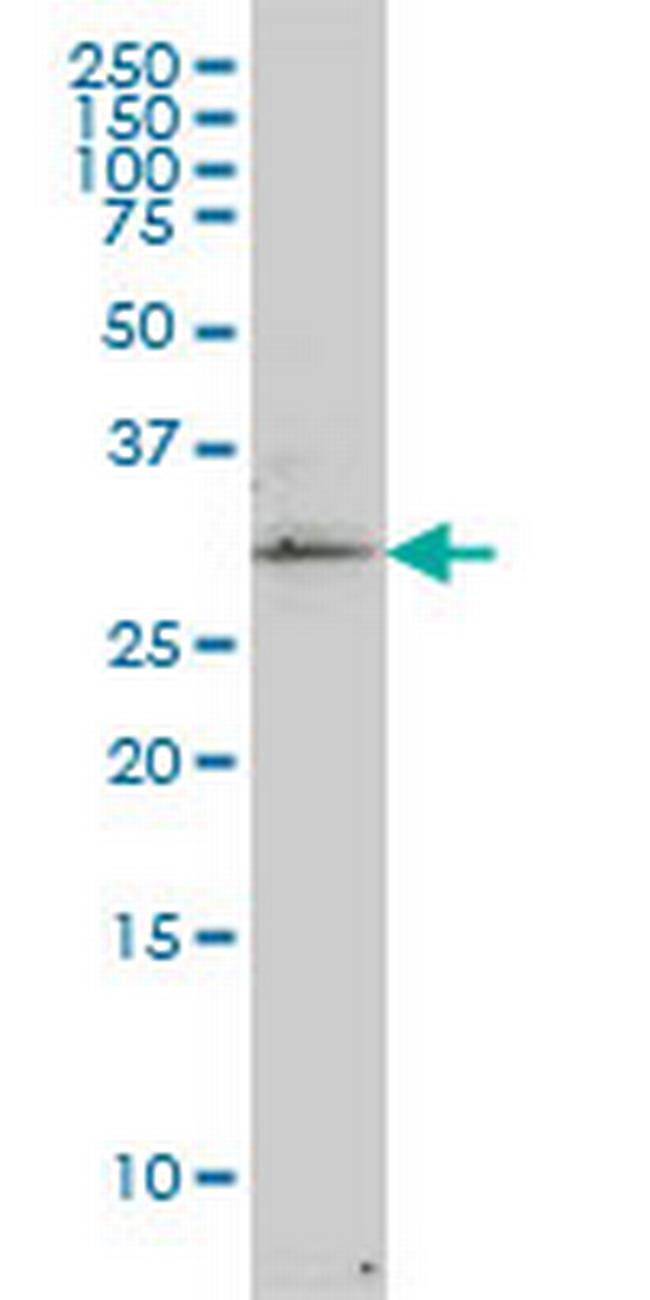 TP53RK Antibody in Western Blot (WB)
