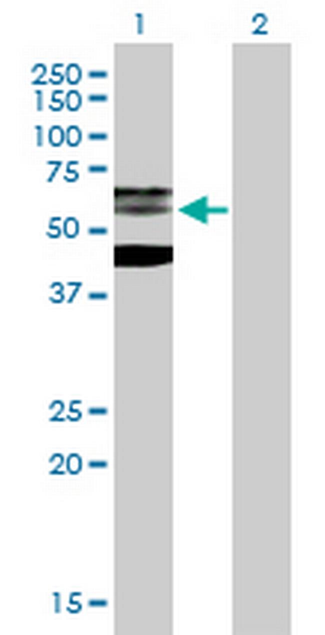 PHF21B Antibody in Western Blot (WB)