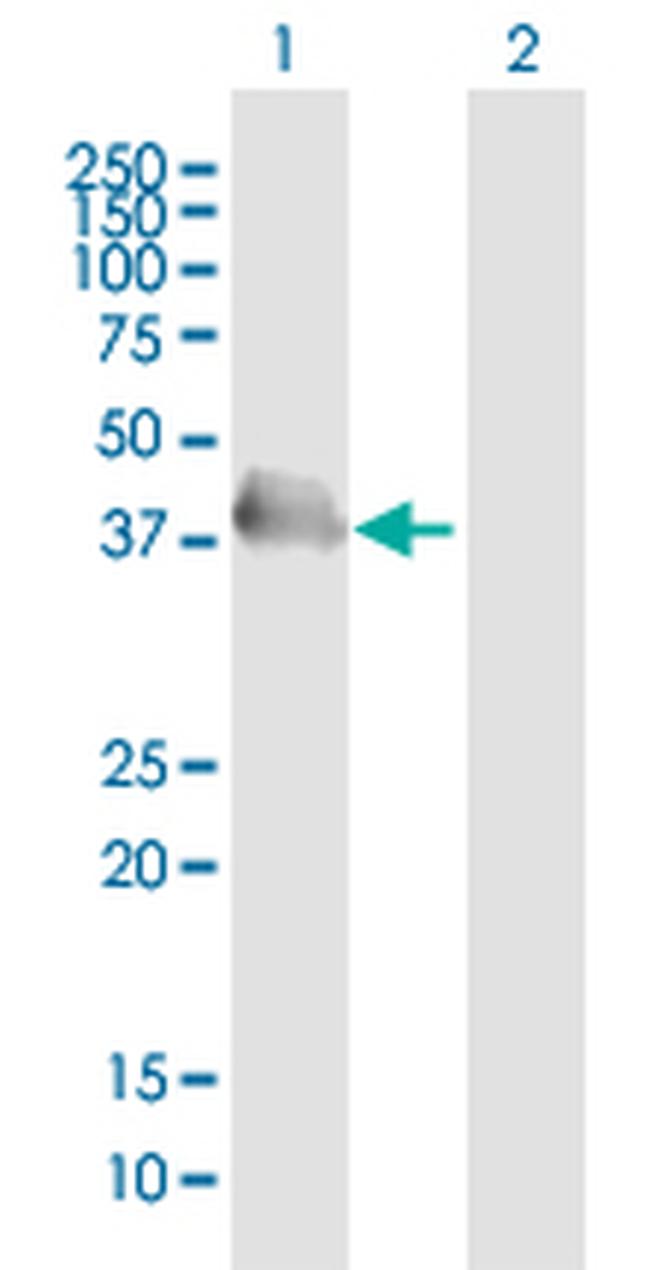 HEL308 Antibody in Western Blot (WB)