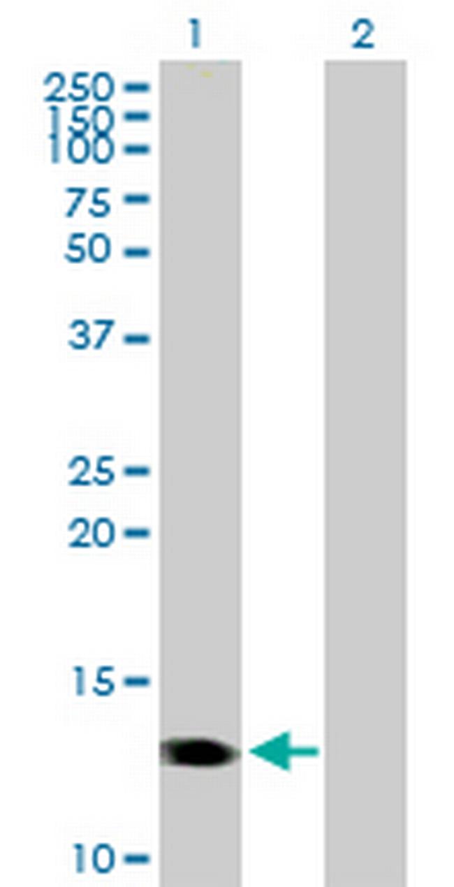 CMTM1 Antibody in Western Blot (WB)
