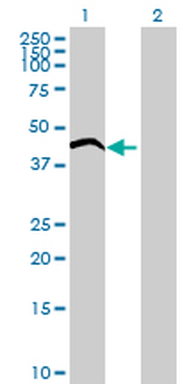 ADPRHL1 Antibody in Western Blot (WB)