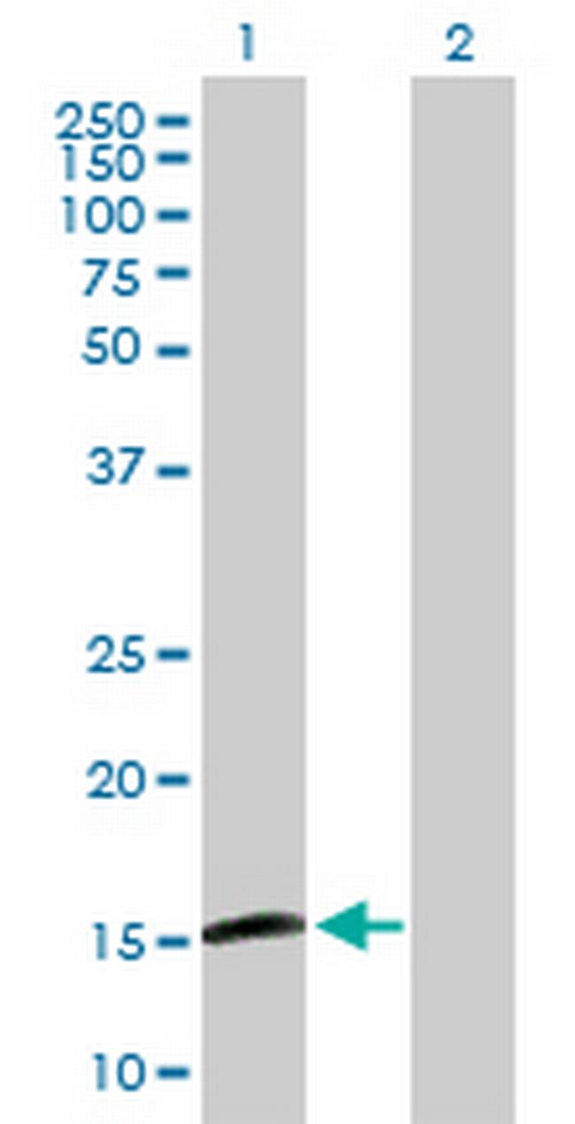 MGC16703 Antibody in Western Blot (WB)