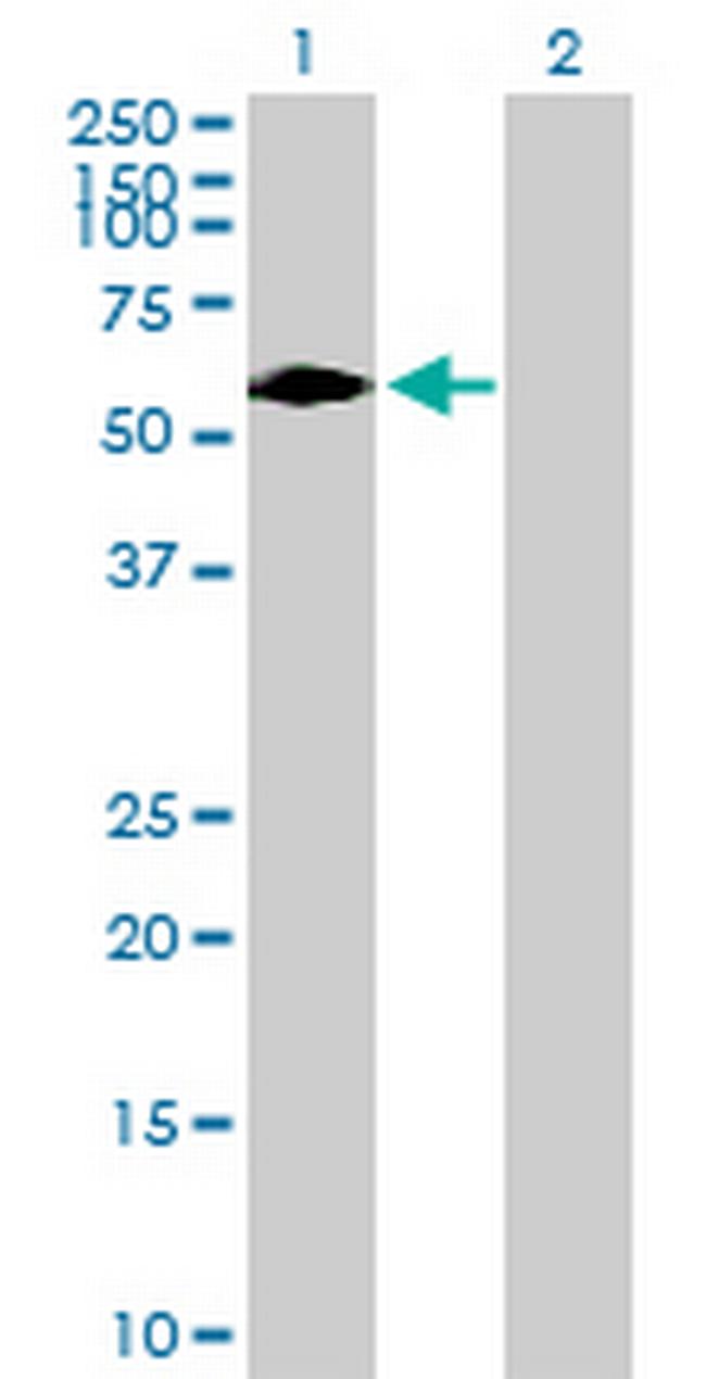 DTX2 Antibody in Western Blot (WB)