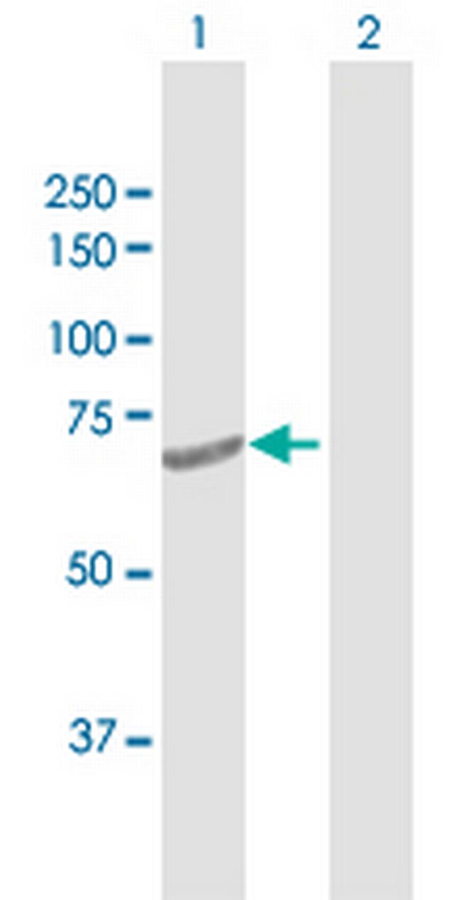 DTX2 Antibody in Western Blot (WB)