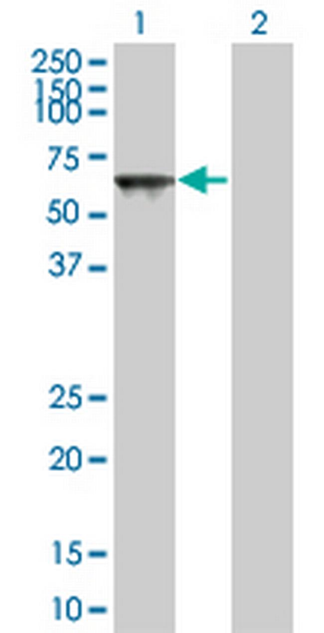 TOE1 Antibody in Western Blot (WB)