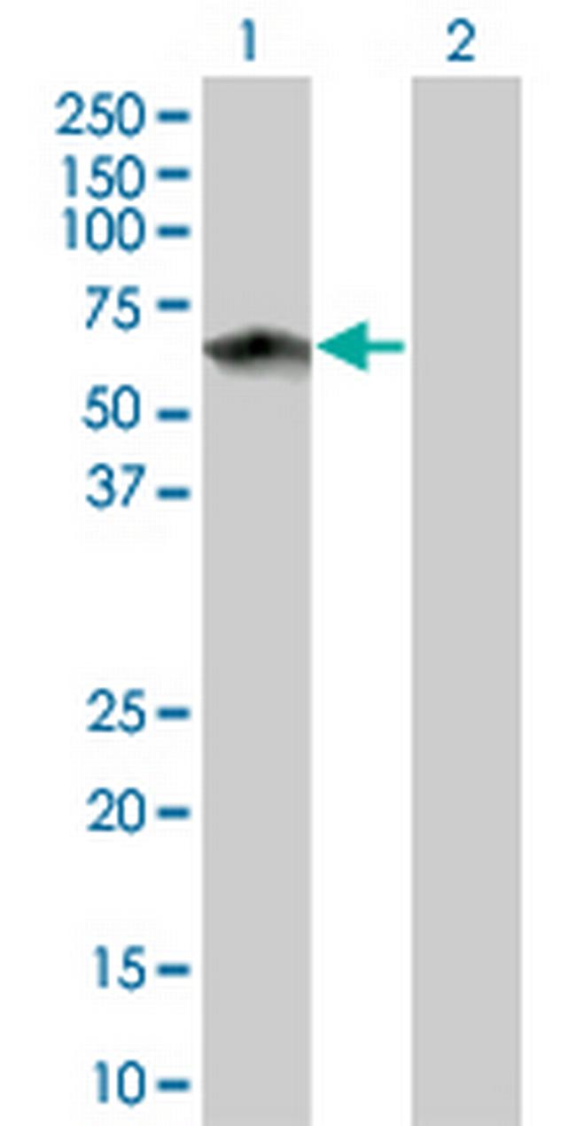 TOE1 Antibody in Western Blot (WB)