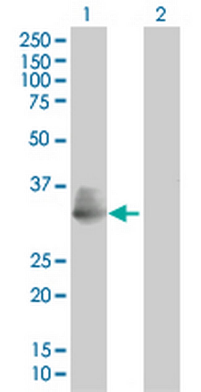 TIRAP Antibody in Western Blot (WB)