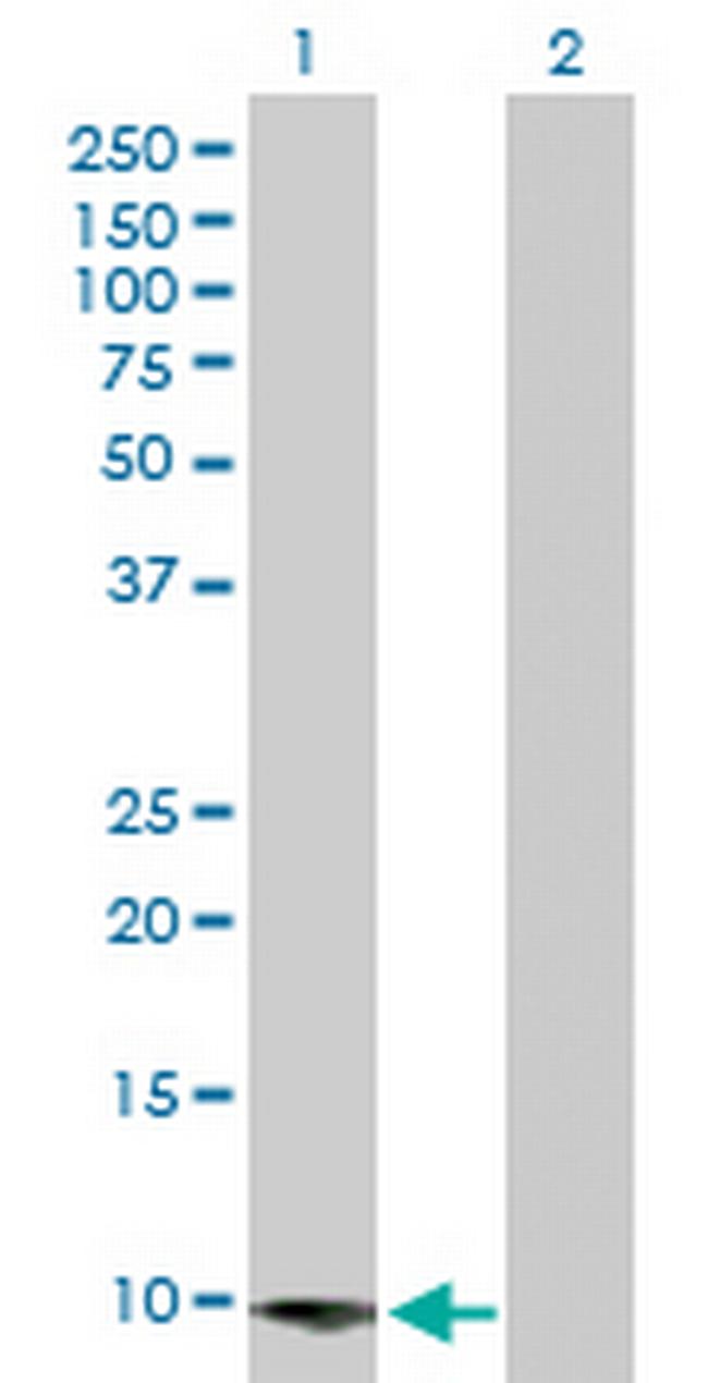 COP1 Antibody in Western Blot (WB)