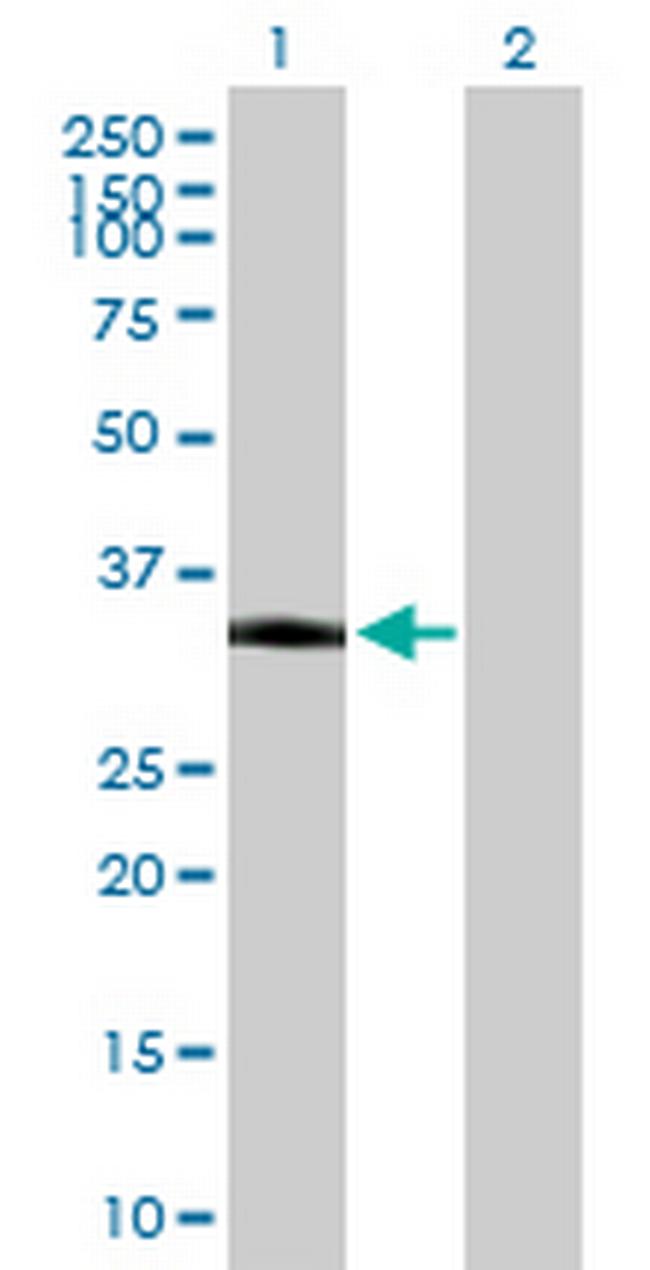 PKD1L2 Antibody in Western Blot (WB)