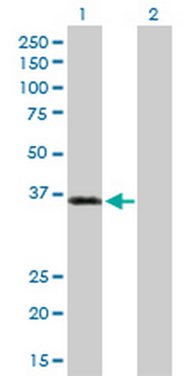 PKD1L2 Antibody in Western Blot (WB)