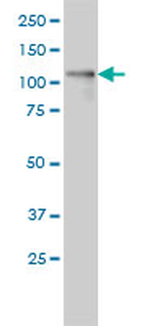 PKD1L2 Antibody in Western Blot (WB)