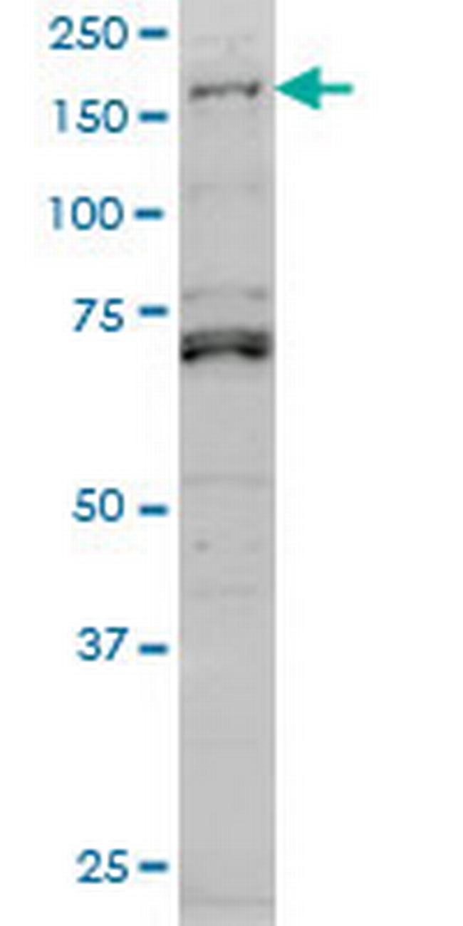 LMTK3 Antibody in Western Blot (WB)