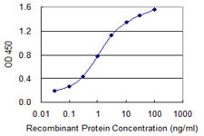 LMTK3 Antibody in ELISA (ELISA)