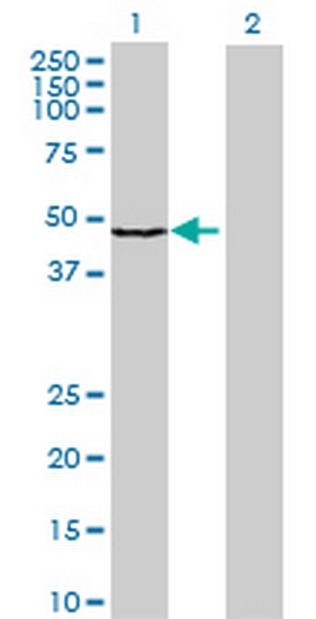 SLC25A25 Antibody in Western Blot (WB)