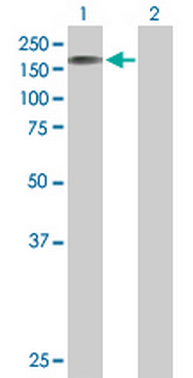 STK11IP Antibody in Western Blot (WB)
