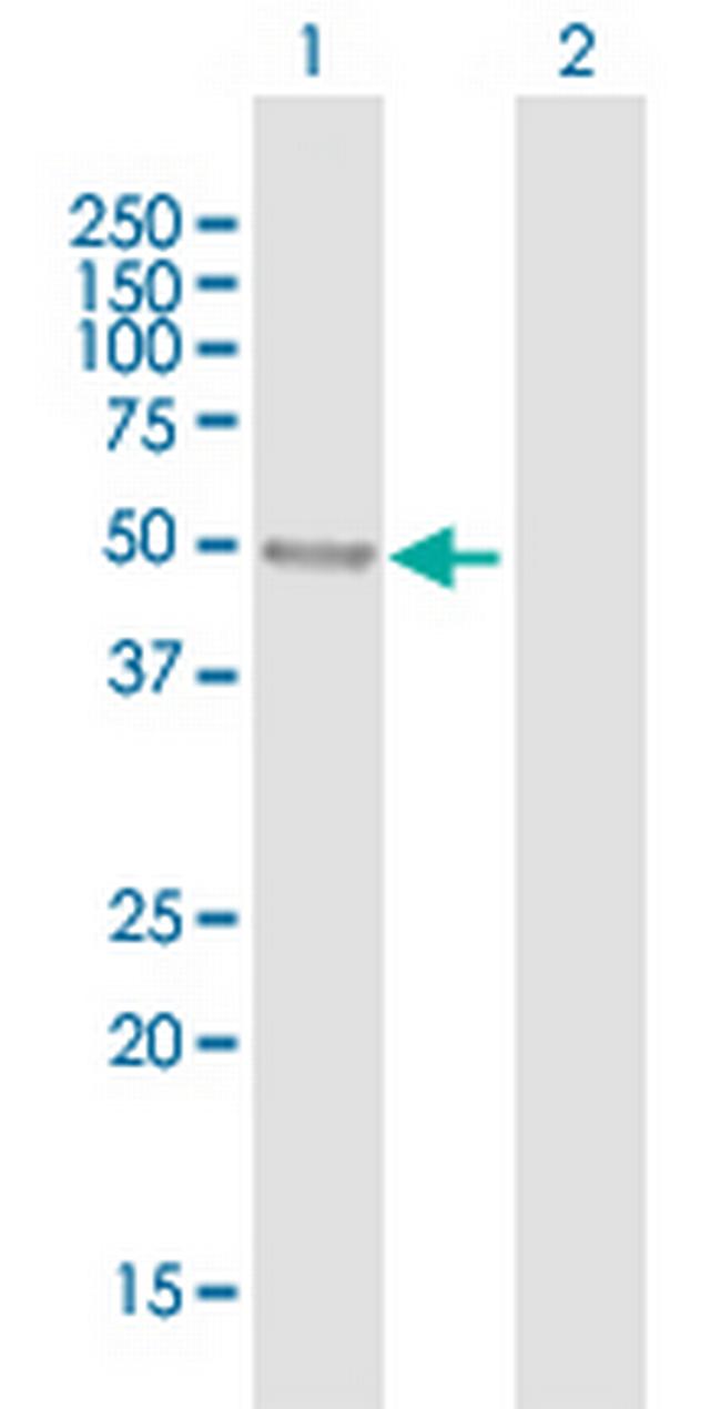 KLHL32 Antibody in Western Blot (WB)