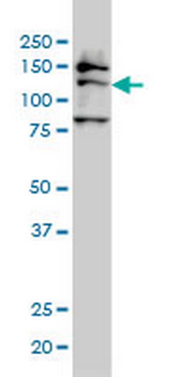 FMNL2 Antibody in Western Blot (WB)