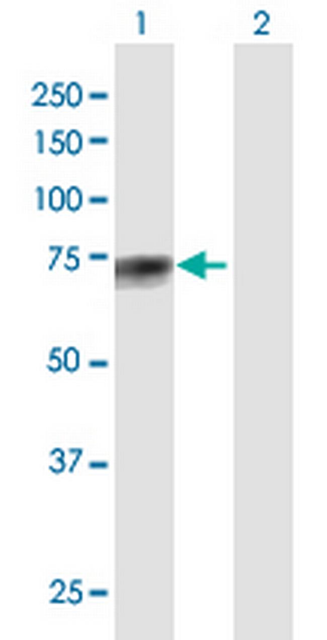 GALNT13 Antibody in Western Blot (WB)