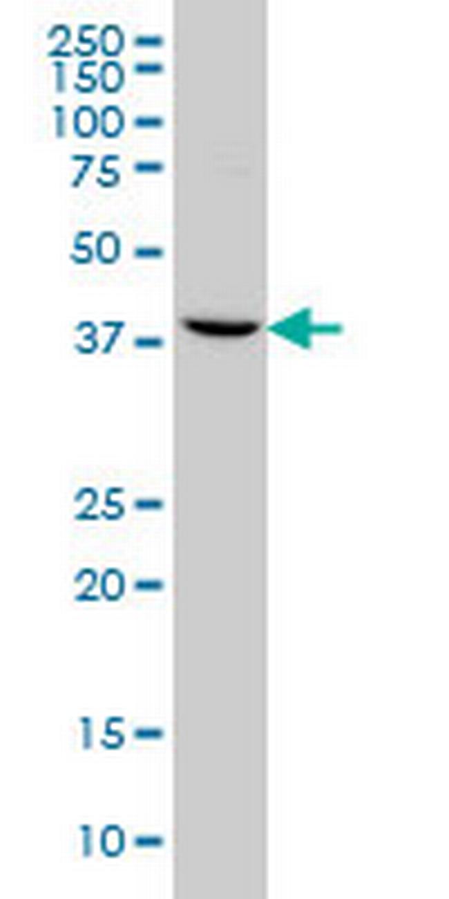 GNRHR2 Antibody in Western Blot (WB)