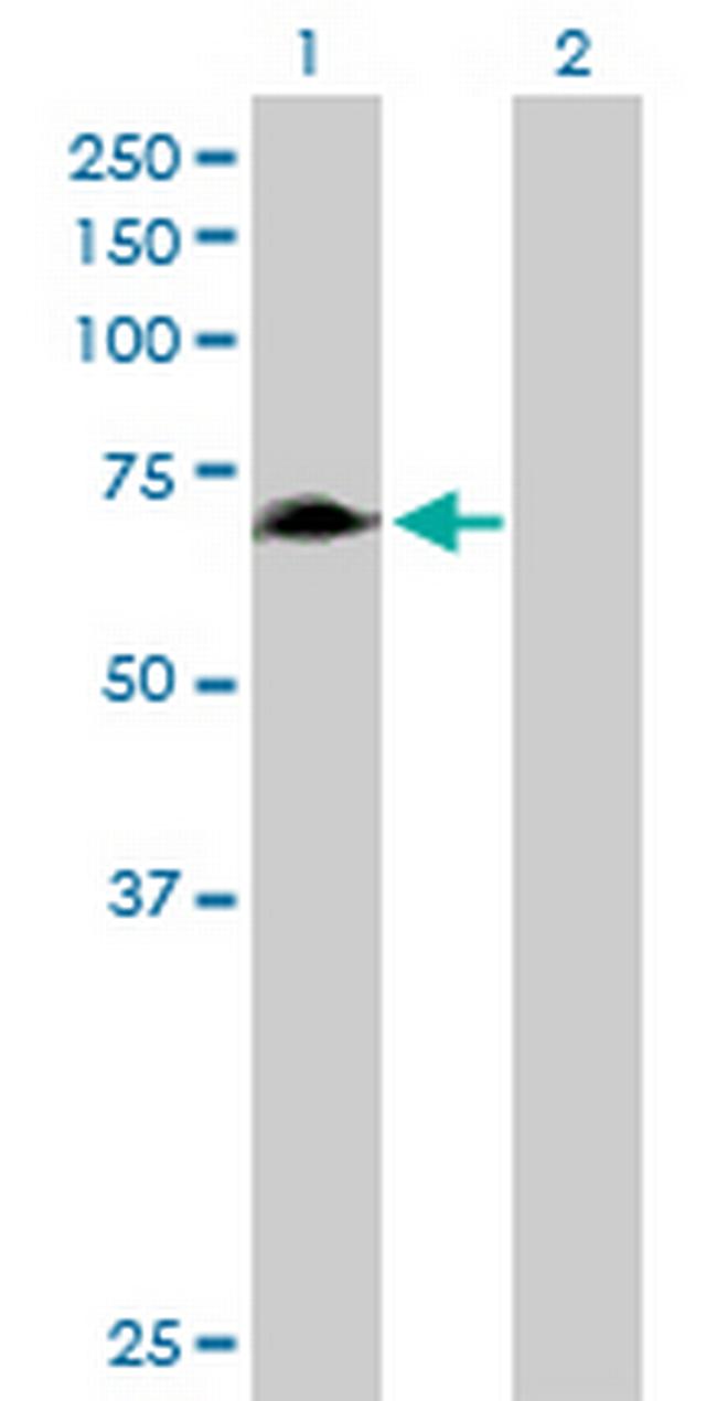 RHPN1 Antibody in Western Blot (WB)