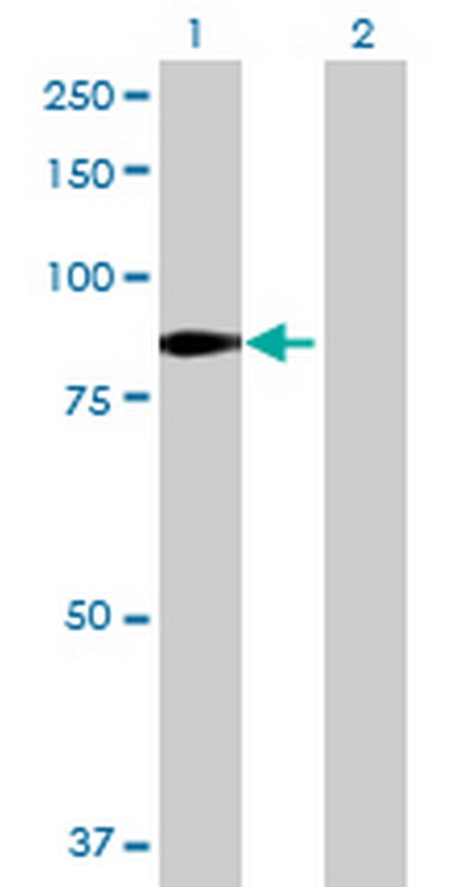OSBPL10 Antibody in Western Blot (WB)