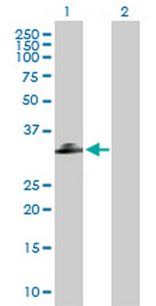 C1QTNF2 Antibody in Western Blot (WB)