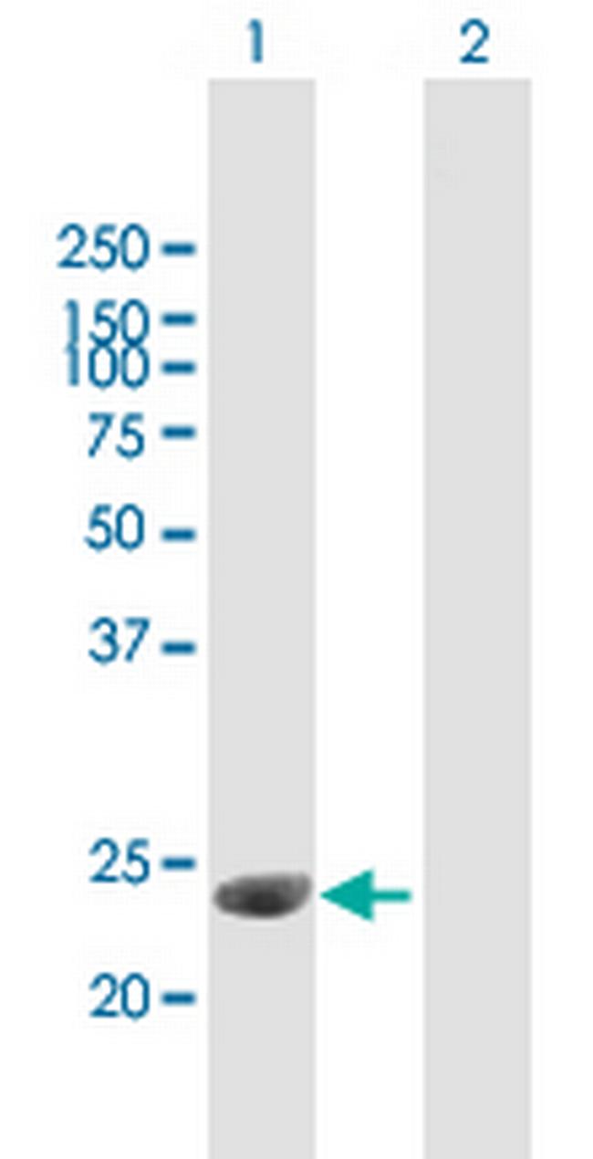 C1QTNF3 Antibody in Western Blot (WB)