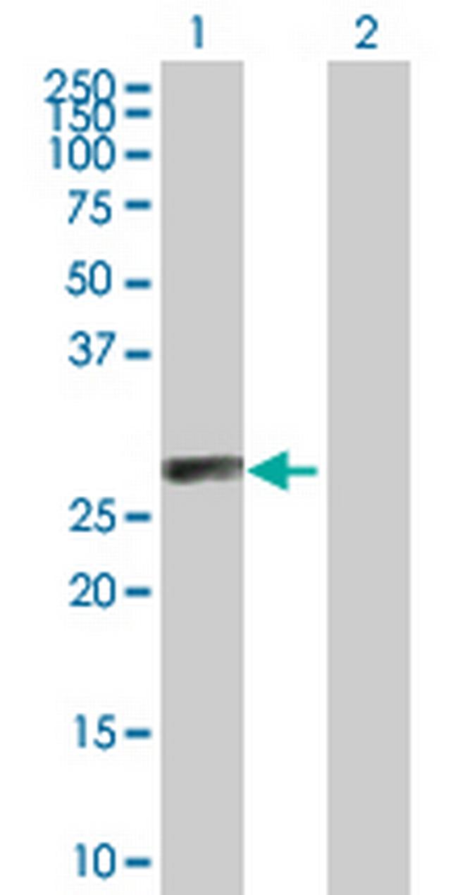 C1QTNF6 Antibody in Western Blot (WB)