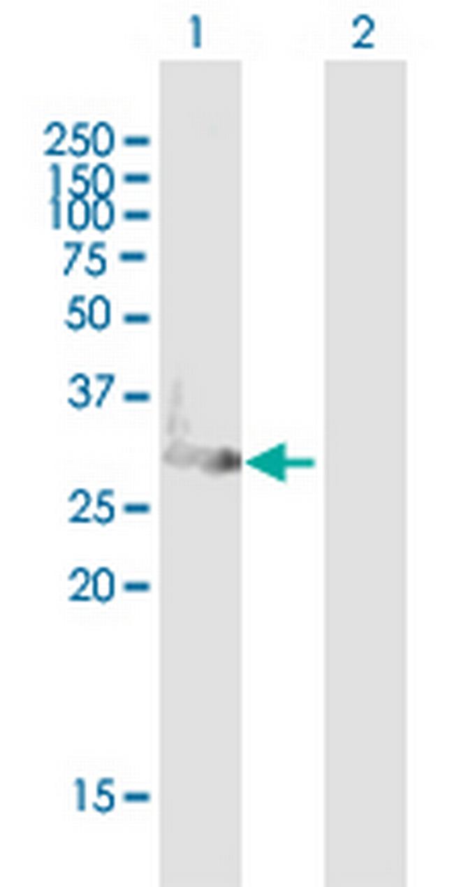 C1QTNF6 Antibody in Western Blot (WB)