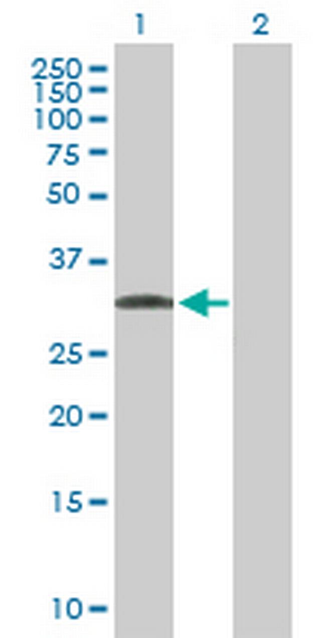 C1QTNF7 Antibody in Western Blot (WB)
